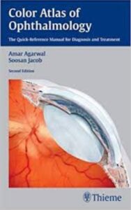 Read more about the article Color Atlas of Ophthalmology by Amar Agarwal