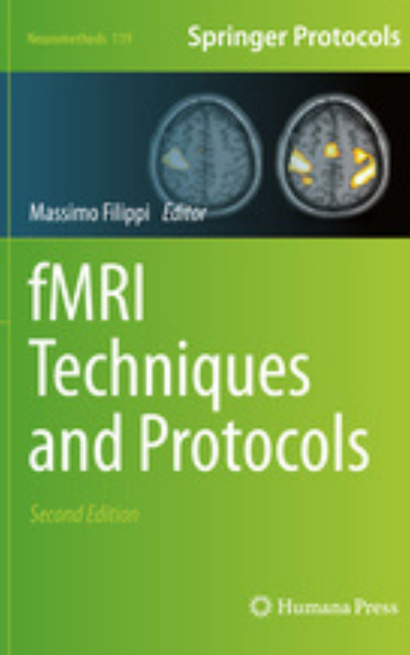 You are currently viewing fMRI Techniques and Protocols by Massimo Filippi