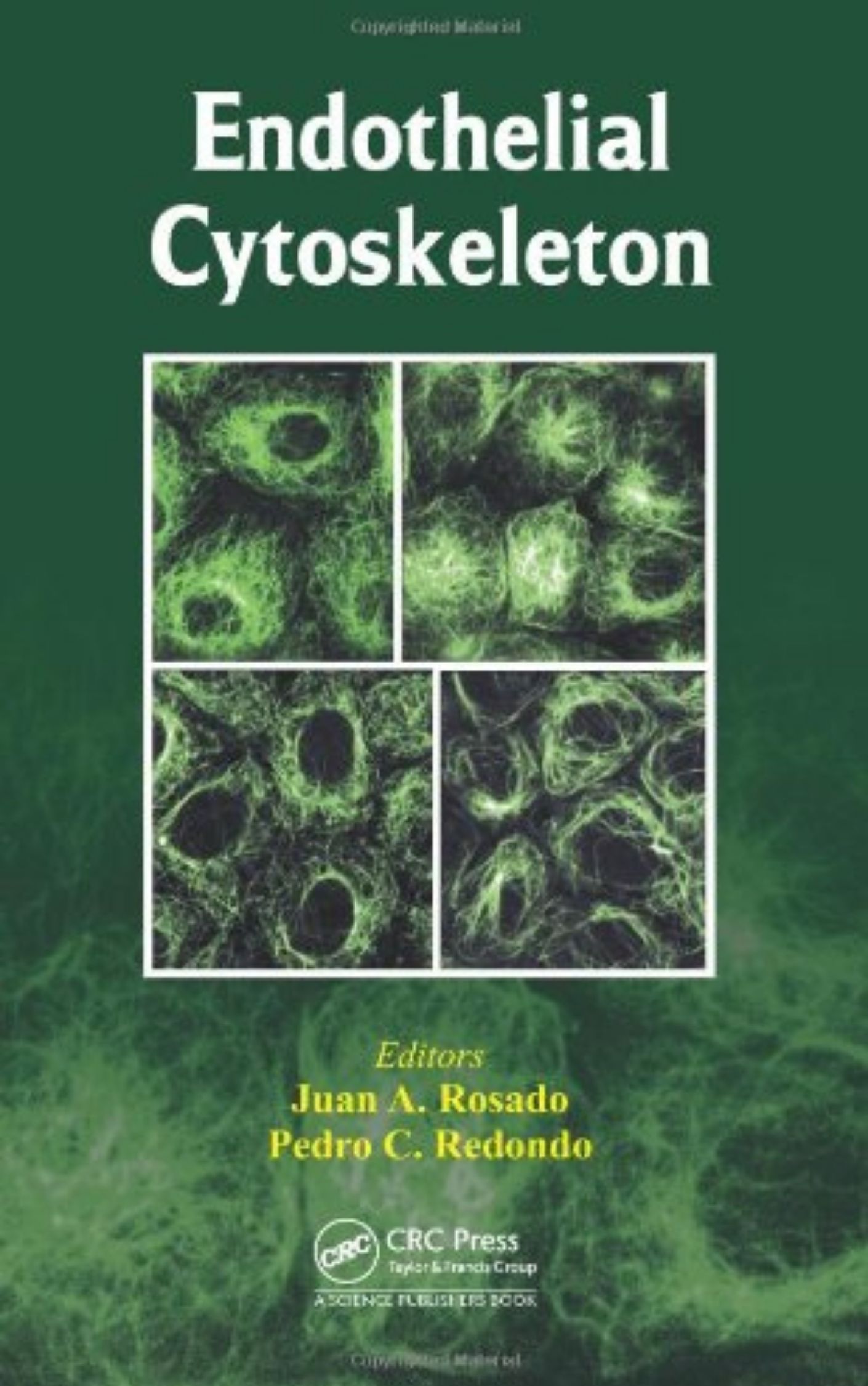 You are currently viewing Endothelial Cytoskeleton by Sarah Y Yuan