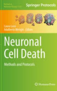 Read more about the article Neuronal Cell Death Methods and Protocols by Laura Lossi